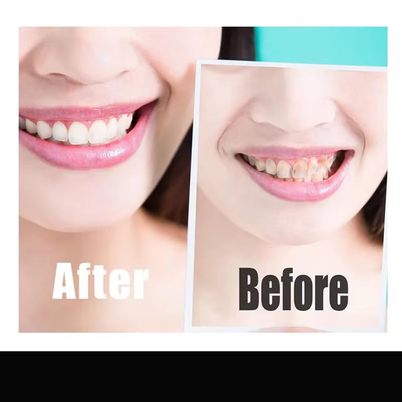 14-Piece Charcoal Teeth Whitening Strips - Remove Coffee & Tea Stains for a Brighter Smile!